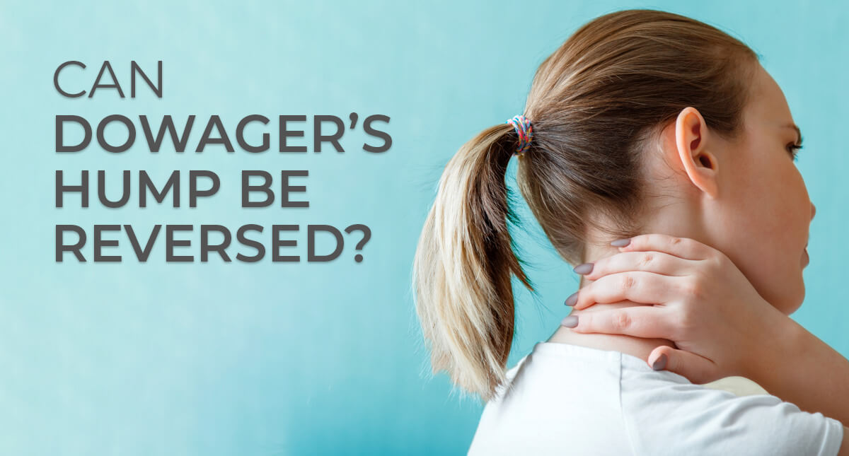 How to treat Dowager’s Hump: Chiropractic Solutions