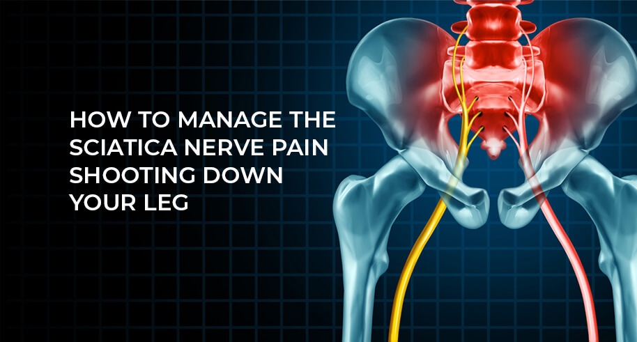 Sciatica Pain Management: How to Relieve Shooting Leg Pain